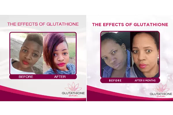 Glutathione South Africa